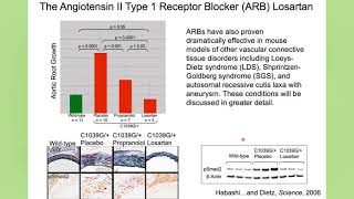 Imaging In Aortopathy: Marfan and Loeys-Dietz Syndromes