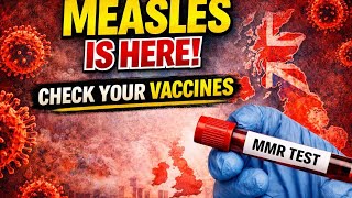 Measles is back: what immunosuppression means for MS, vaccines, and your MMR check