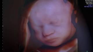 Little Yawn at 29 Weeks