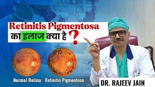 What is Retinitis Pigmentosa? | Treatment option of Retinitis Pigmentosa
