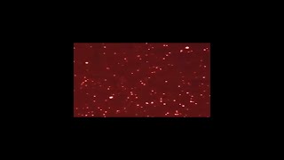 needunow remix