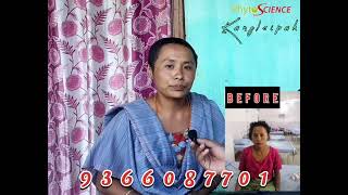 Womb Cancer Cure SHIDA HIDAK stem cell therapy   ||   9366087701  Stem cell Expert