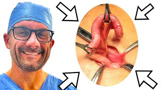 The Mysterious Function and Benefit of the Appendix