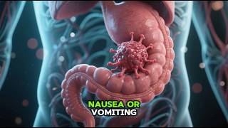 Rare Stomach Cancers You’ve Never Heard Of Squamous Cell & Sarcomas Explained