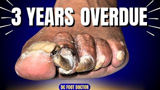 3 Years Overdue