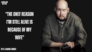 World’s First Face & Eye Transplant | The Man Who Survived the Impossible - Aaron James (Part 1)