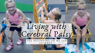 MY ABILITIES BEFORE SURGERY | SDR SURGERY JOURNEY | DAY IN THE LIFE