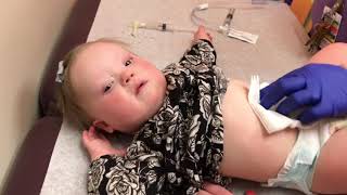 Lainey First G-Tube Relpacement