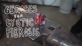 65 Roses for Cystic Fibrosis