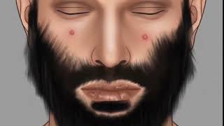 Ingrown Hair ASMR: Soothing Shave & Pimple Removal