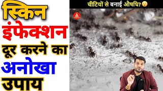स्किन इंफेक्शन को दूर करने का अनोखा उपाय||Arvind arora||fact||short