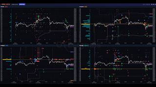 Gold Options Live  | Gold Futures | Max Pain |  0DTE