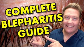 Everything about Blepharitis Types, Symptoms & Treatment
