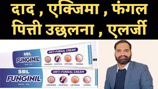 Funginil cream uses in hindi | Funginil cream composition 