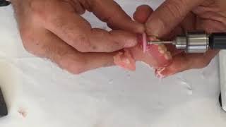 TCS Quick Tip 10 - Finishing A Flexible Partial Part 2