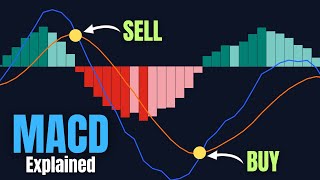 Most Traders Use MACD Wrong 😳 Here’s the Right Way to Trade It