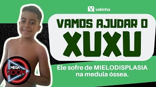 Vamos AJUDAR O XUXU! Criança que sofre com doença RARA - MIELODISPLASIA!