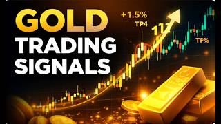 🔴GOLD LIVE Scalping – High-Precision XAUUSD Day Trading
