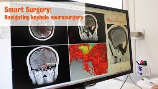 Smart Surgery: Navigating keyhole neurosurgery, quicker and safer