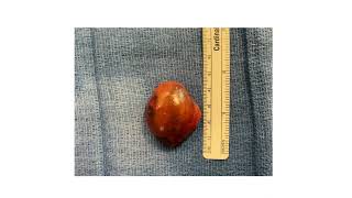 Interesting case of the week: Mistaken Identity with Dr. Kevin Parrack