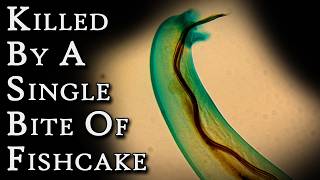 Unusual Food Deaths (Part One) - Three Strange Deaths Caused by Food | Fascinating Horror