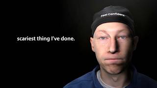 I'm a plastic surgeon... This is why I stopped doing facelift surgery