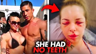 The Actress Who Was BRUTALLY TORTUR*D By Rage Filled Ex For 6 HOURS  |  She DRANK Snake Water