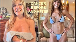 CANCER GONE!    DMSO Before and After.  HOLISTIC CURE for skin cancer