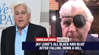 Jay Leno's All black and Blue’ after falling down a hill