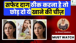 If You Want to Treat Vitiligo, Stop Eating These Foods | Dr. Bharti Makkar