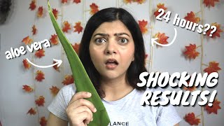 I left aloe vera gel in my hair for 24 hours and this happened... | Divya Singh