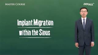 [Master Course - SURGERY] Implant Migration within the Sinus