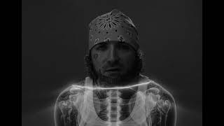 Caskey - Dave Chapelle Ft. ClicKlak (Official Music Video)