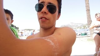 STUNG BY A JELLYFISH!