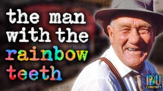 Harold's Opal Teeth Part II: A Detailed Denture Deep-Dive