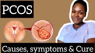 How to cure PCOS (polycystic ovarian syndrome)|PCOS awareness|PCOS and ovulation| Anegbe Perpetual
