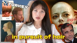 The Crazy History of the Hair Loss Industry