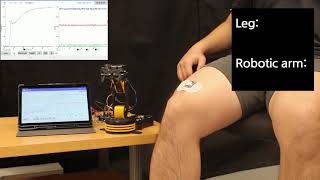 EMG-based control of a robotic arm