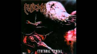 Pyaemia - Impaled on Stakes - HD