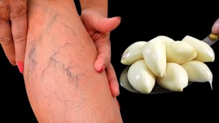 Leg pain, rheumatism, varicose veins, arthritis, headache, joint pain.