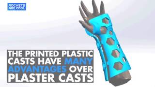Mediprint Plastic Cast