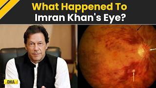 Imran Khan News: '85% Vision Loss' Ex-PM Imran Khan To Stay In Secure 10-Room Facility For Treatment