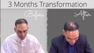 Thinning Hair❓Watch This HairCubed Miracle❗️