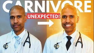 Dr. Hamptons Top 5 Unexpected Benefits on Carnivore!