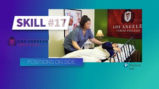 LACC - CNA Skill #17 - Positions on Side