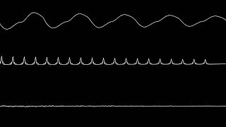 Deltarune - MIKE, the BOARD, please! (C64 Cover)