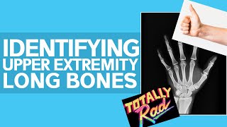 Long Bones of the Arm (Made Super Easy)