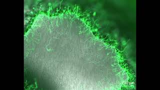 Invasive growth of Aspergillus oryzae in rice koji