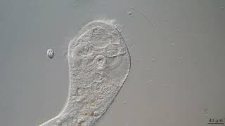 Microscopic World - Protozoa, Stentor sp.