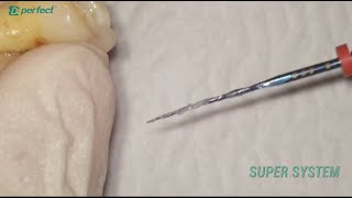 Root Canal Case | Super System: Root canal shaping with Super One File